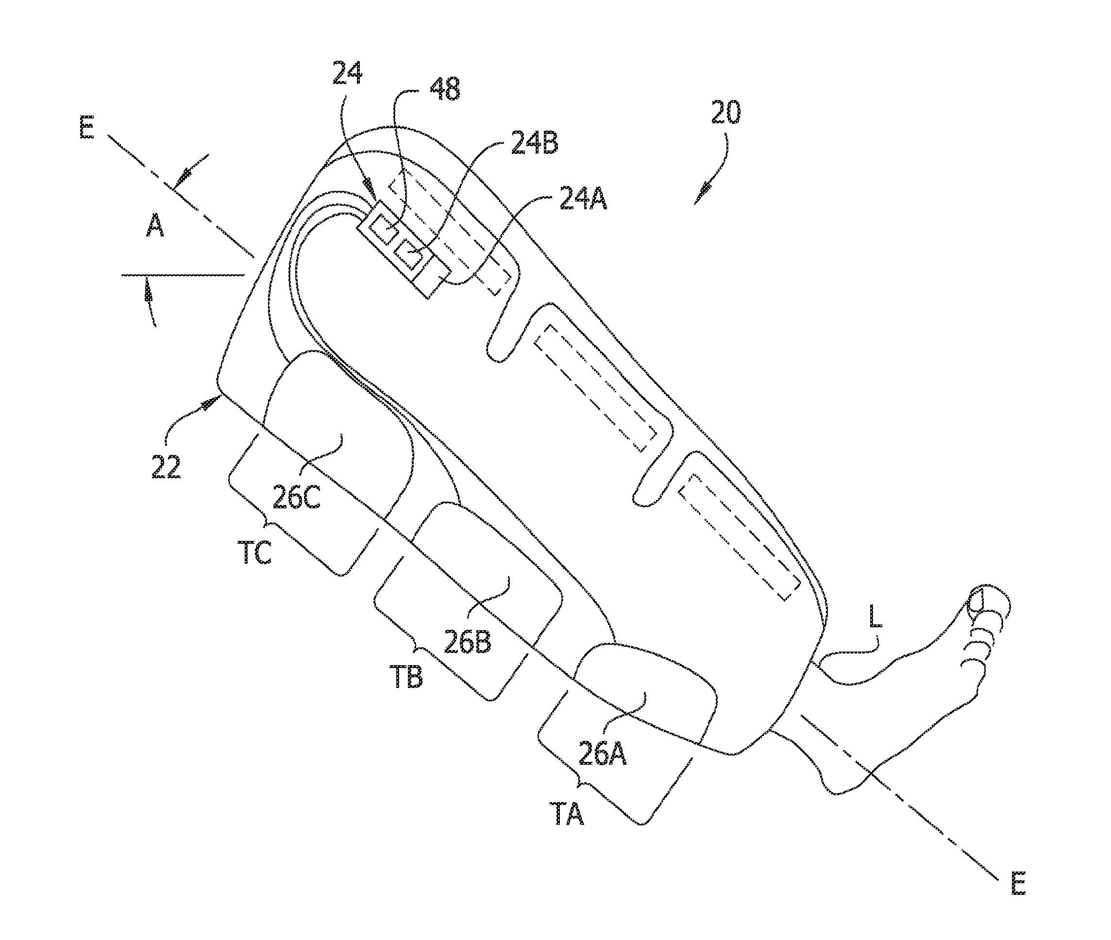 Compression garment apparatus having baseline pressure