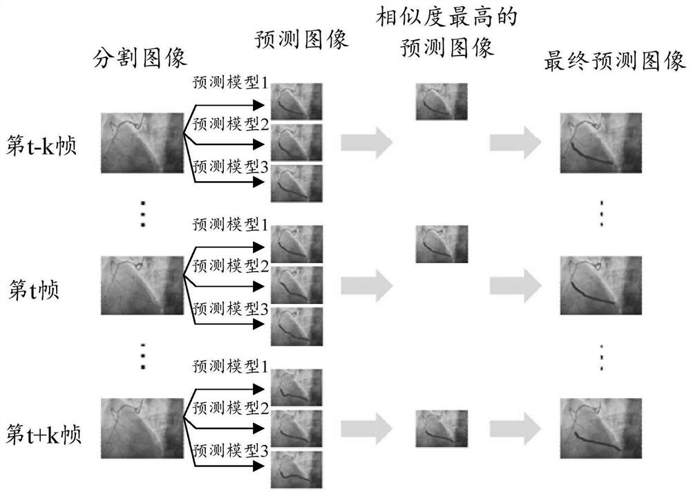 Method for predicting direction of coronary artery, method and device for training prediction model