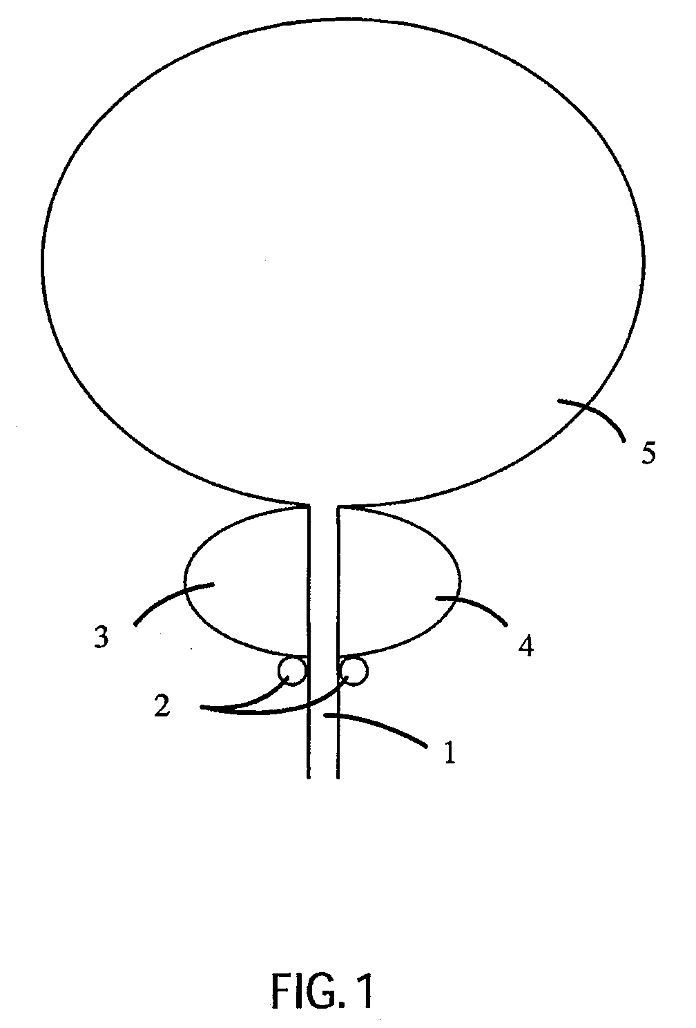 Catheter for Treating Tissue with Non-Thermal Ablation