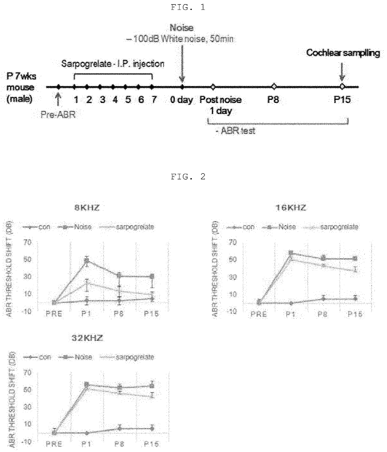 Composition, containing sarpogrelate as active ingredient, for preventing or treating sensorineural hearing loss