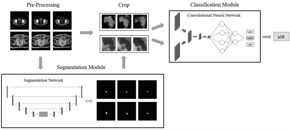 Neural network prediction method for colorectal cancer treatment effect based on MRI and CT images