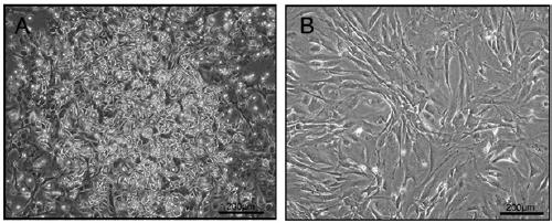 Construction method of mouse bone marrow mesenchymal stem cell lines