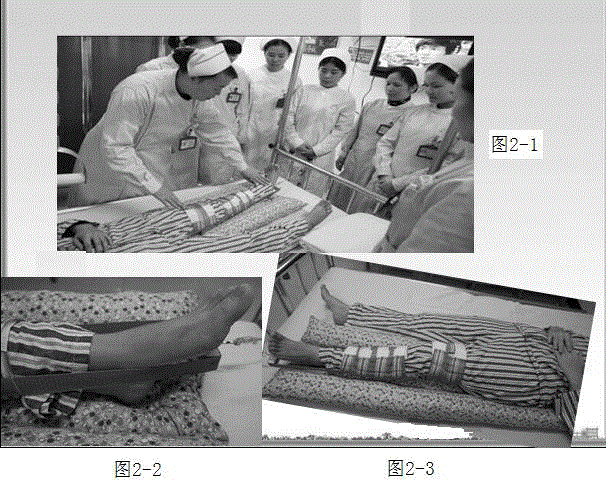 Manufacturing method and application of long pillow with holes for treating femoral neck fractures