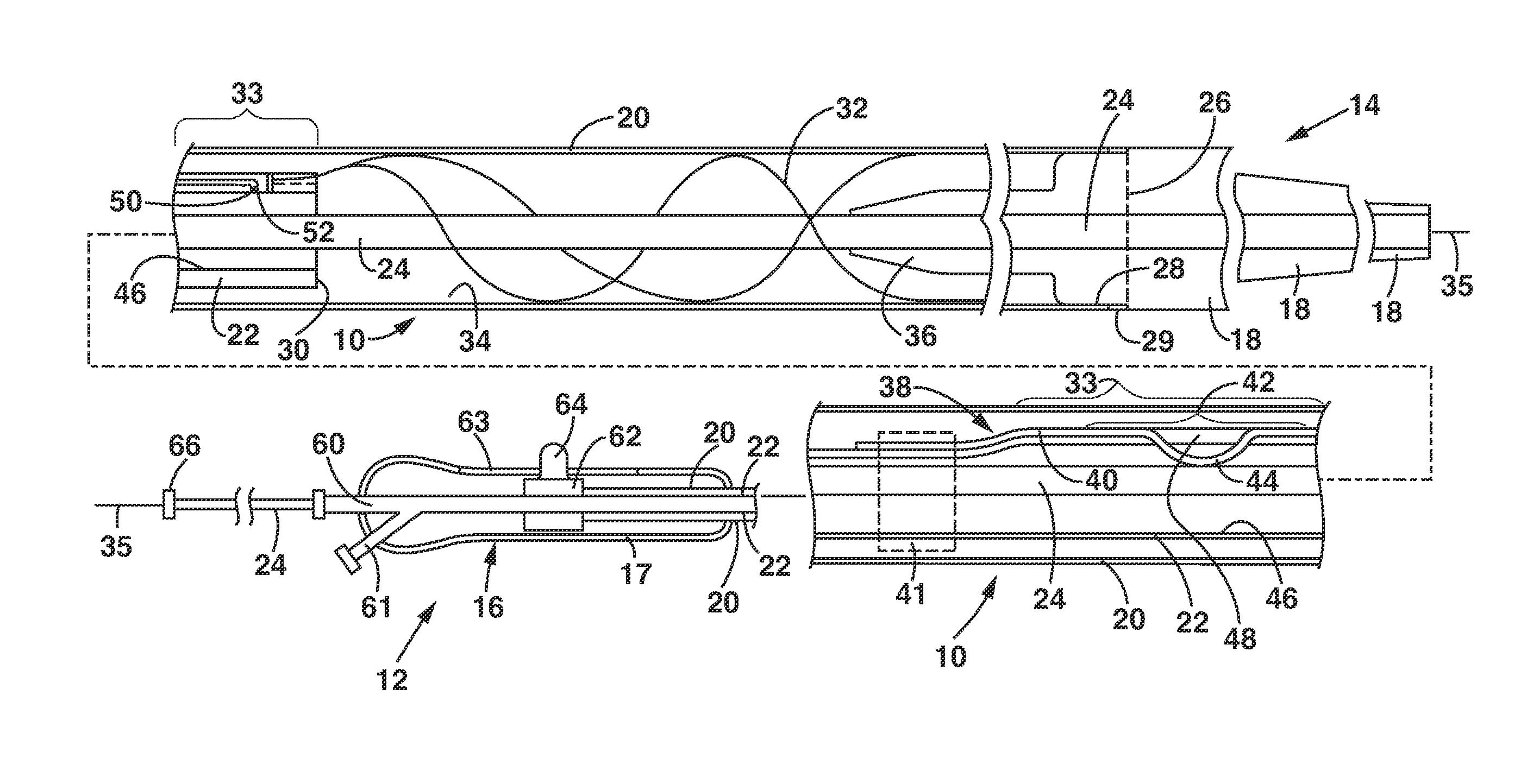 Delivery and Deployment Catheter for an Implantable Medical Device