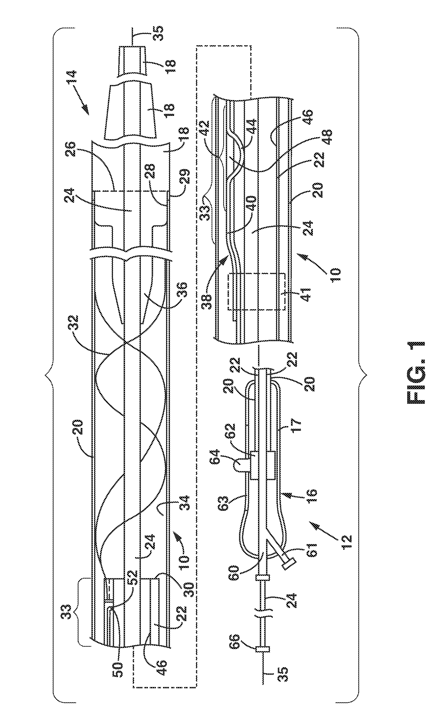 Delivery and Deployment Catheter for an Implantable Medical Device