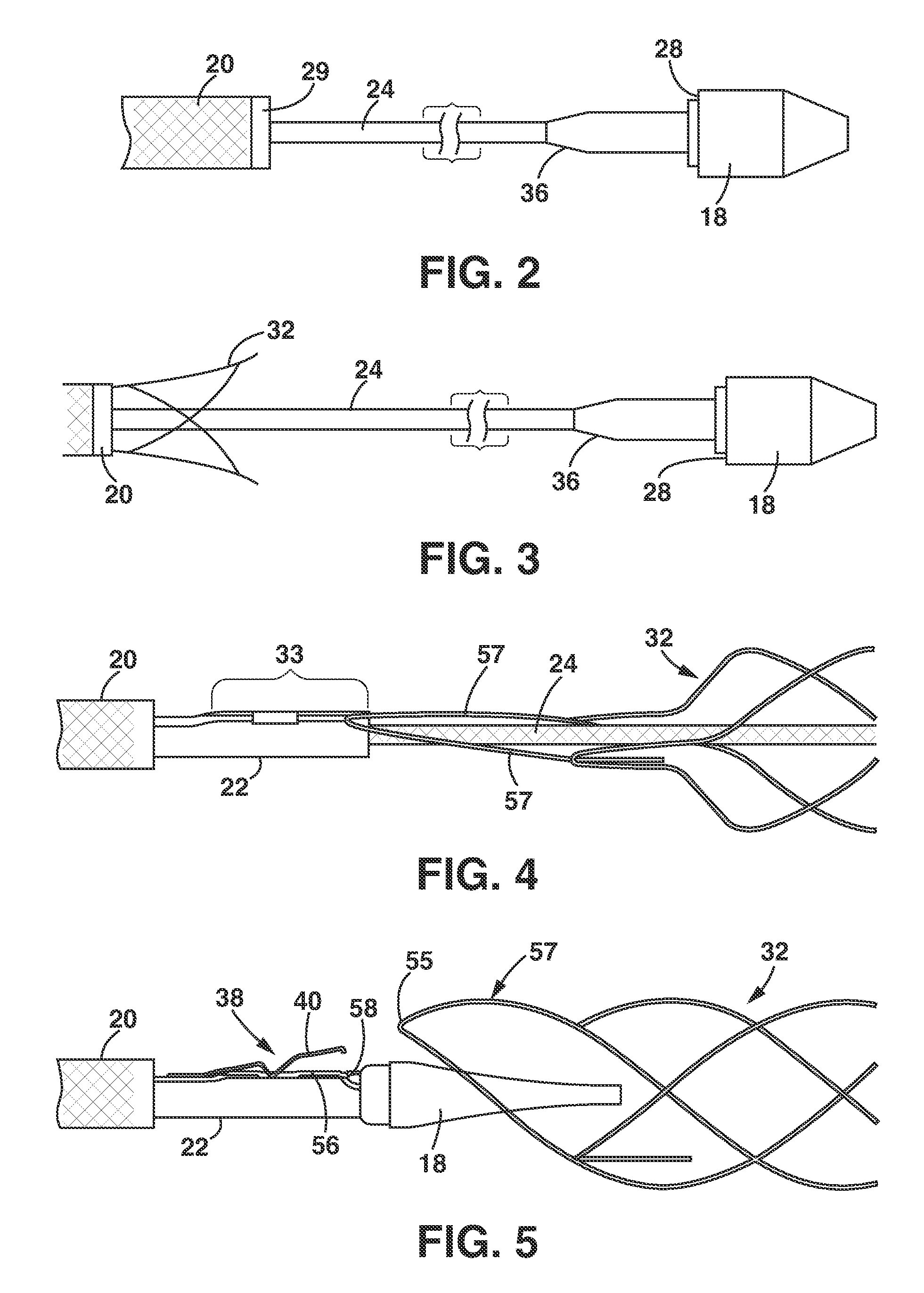 Delivery and Deployment Catheter for an Implantable Medical Device