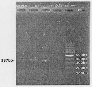 Lactobacillus fermentum strain and application thereof