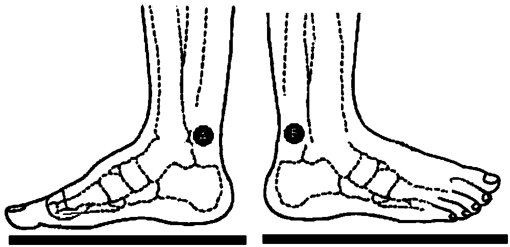 Foot ring and an application method