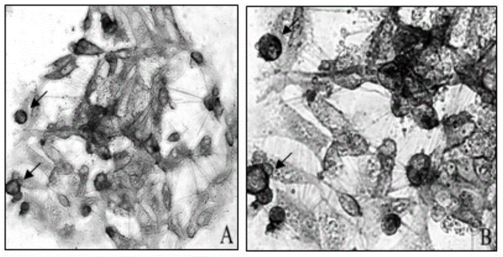 Erythroculter ilishaeformis spermatogonia stem cell separation and culture method