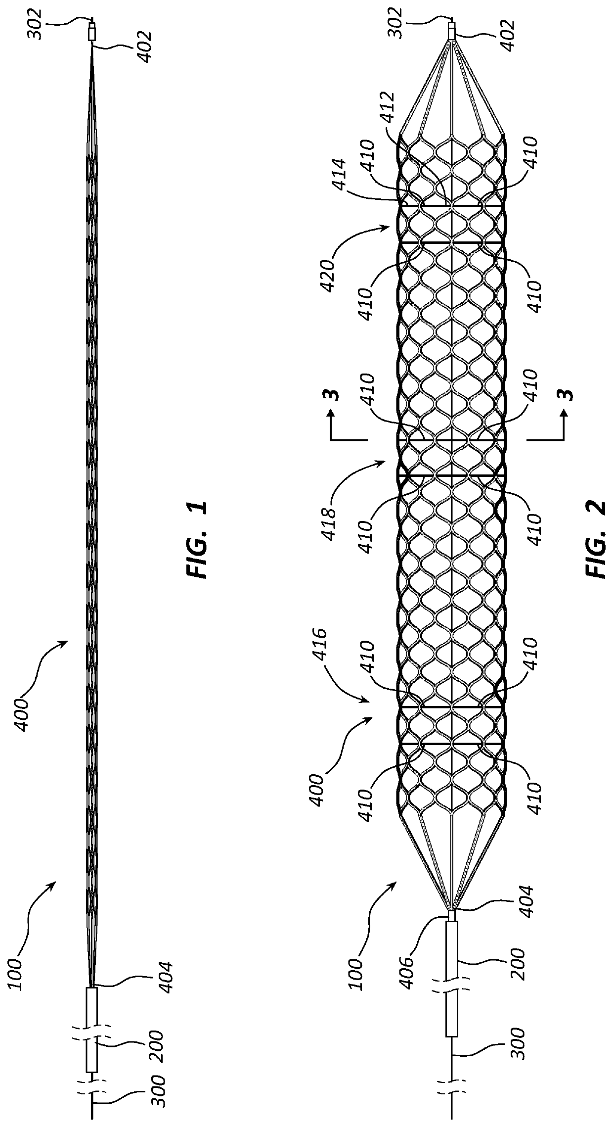 Systems and methods for delivery retrievable stents