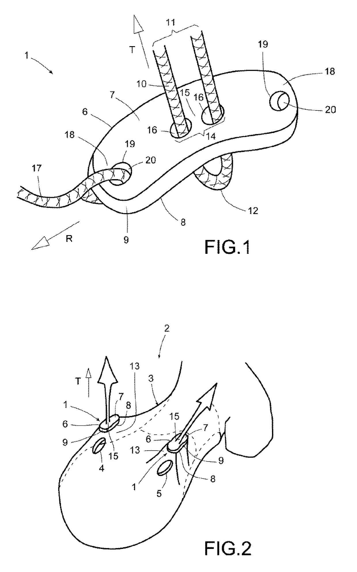 Device for arthroscopic use, and method of diagnosis or treatment of joint ailments using said device