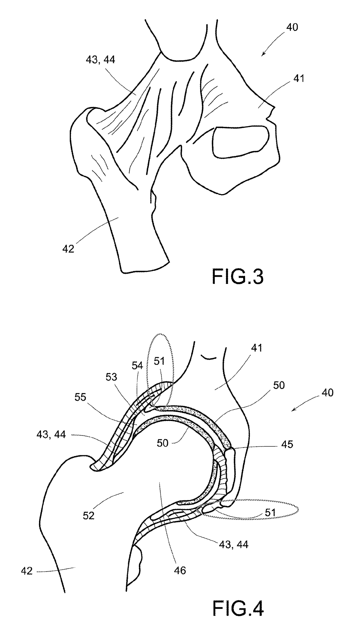 Device for arthroscopic use, and method of diagnosis or treatment of joint ailments using said device