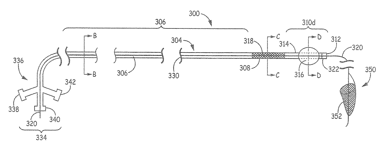 Aortic arch filtration system for carotid artery protection