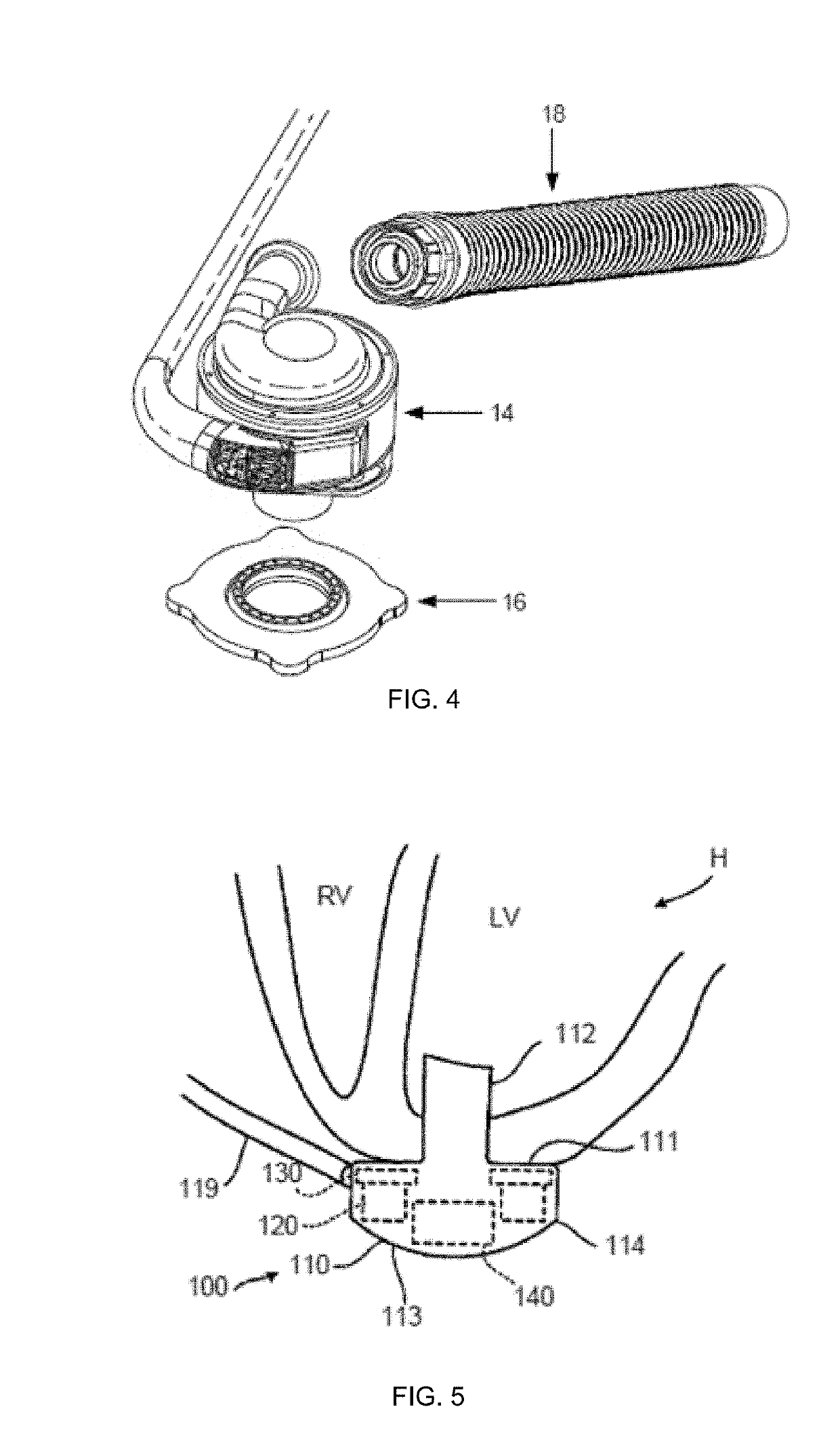 Mechanical Gauge for Estimating Inductance Changes in Resonant Power Transfer Systems With Flexible Coils for Use With Implanted Medical Devices