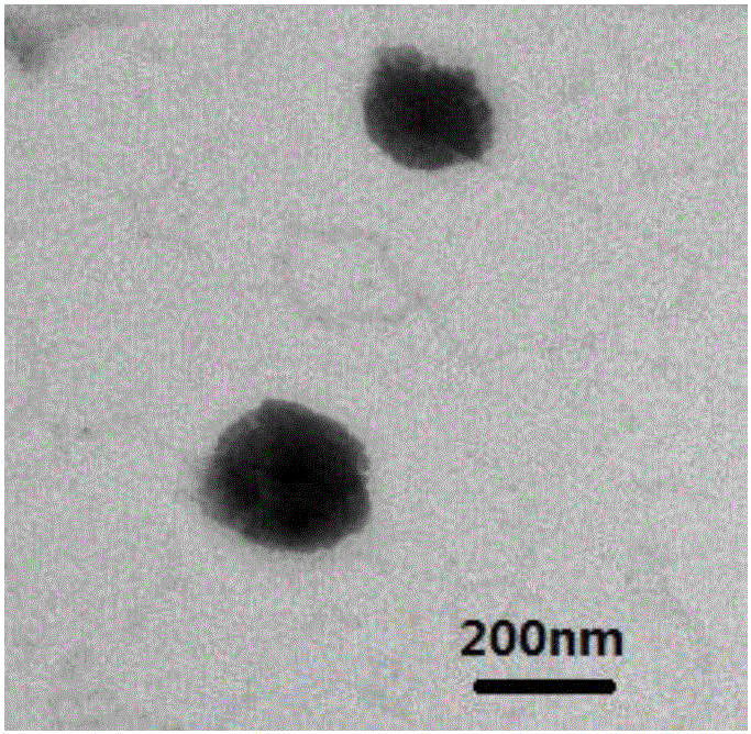 Octreotide-modified gold spherical shell nano liposome and preparation method thereof