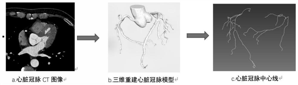 Automatic Segmentation Naming Method for Cardiac Coronary Vessels