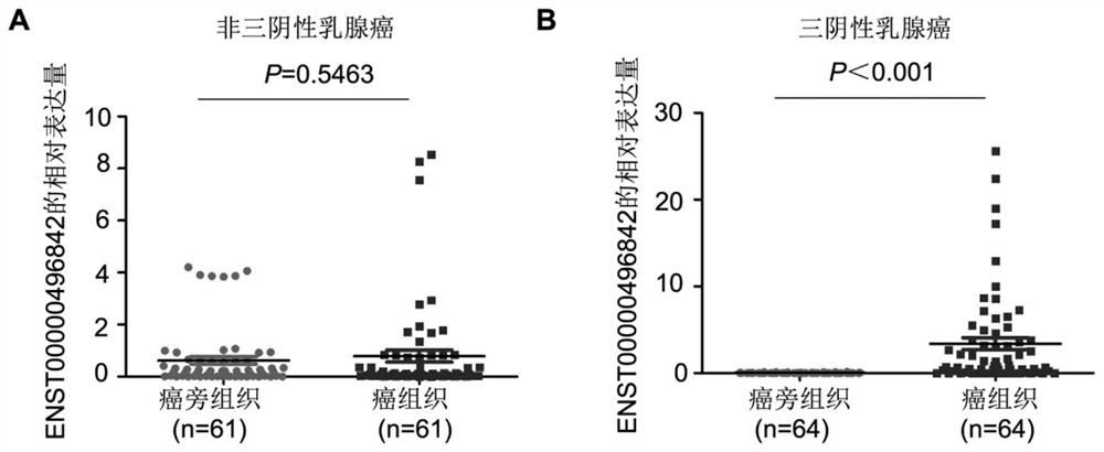 Application of long-chain non-coding RNA molecule in diagnosis and/or treatment of triple-negative breast cancer