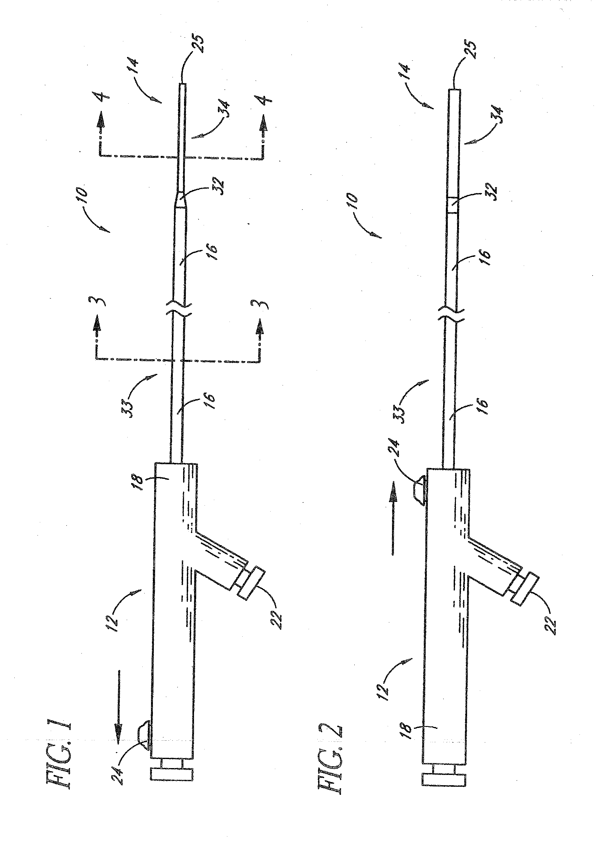 Systems And Methods For Removing Obstructive Matter From Body Lumens And Treating Vascular Defects