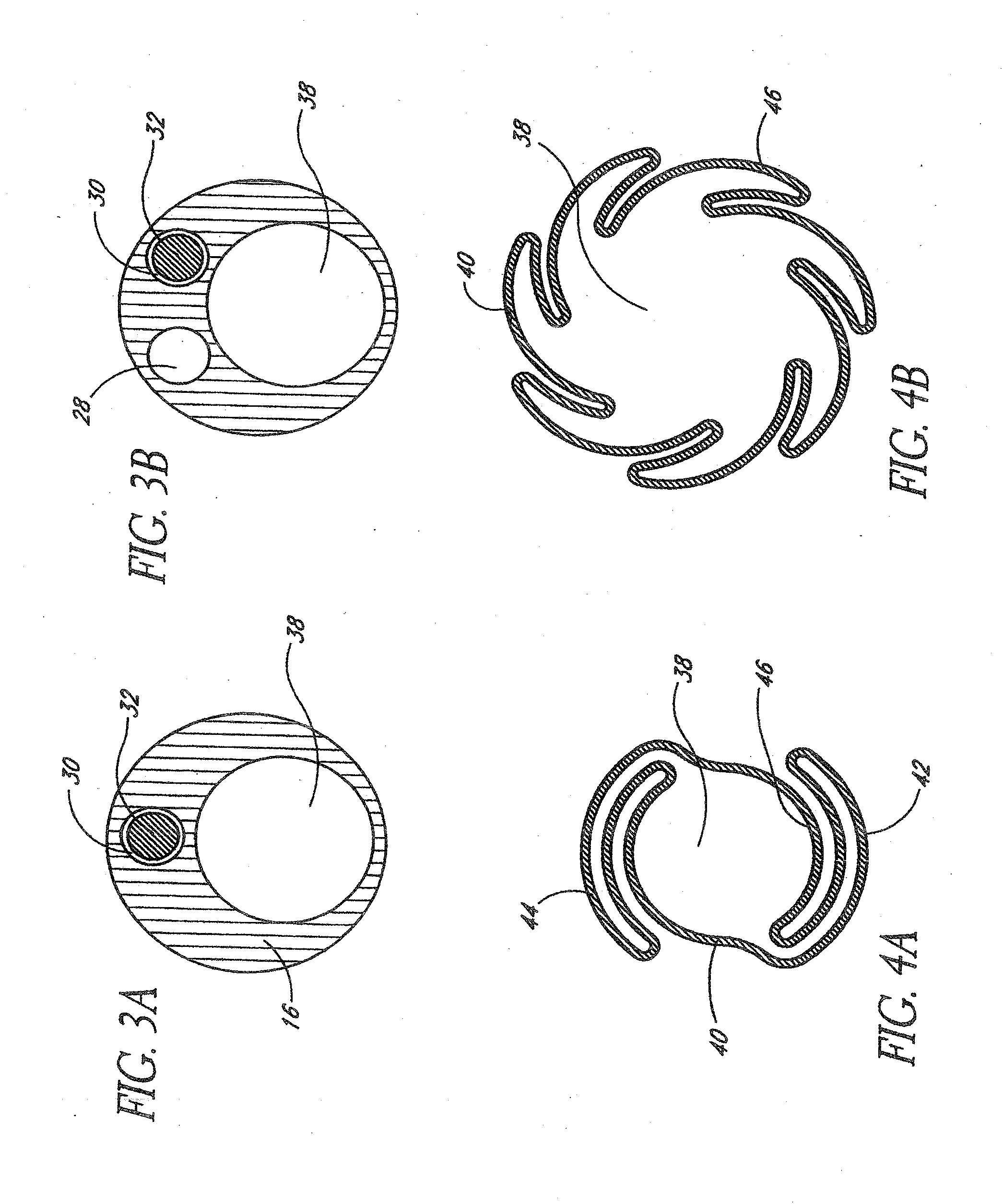 Systems And Methods For Removing Obstructive Matter From Body Lumens And Treating Vascular Defects