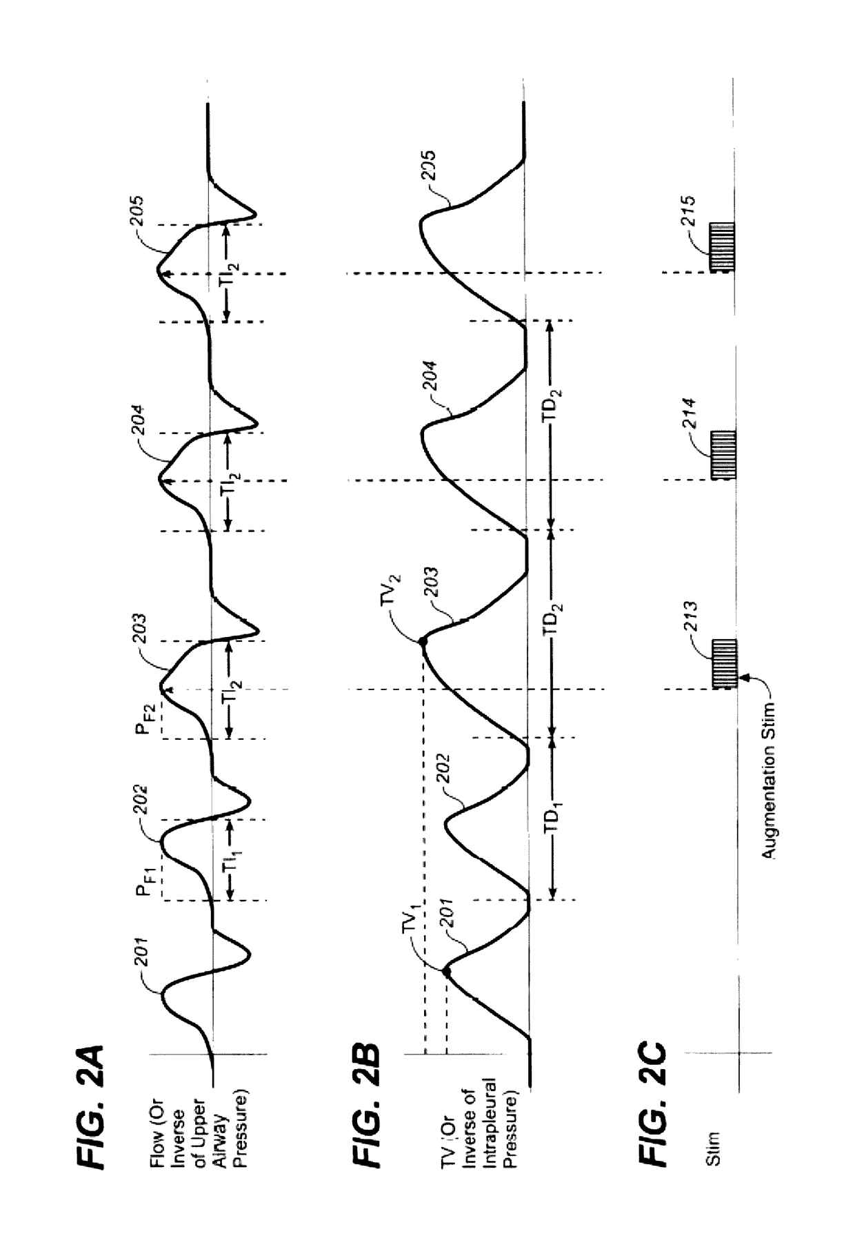 Devices and methods for reducing intrathoracic pressure