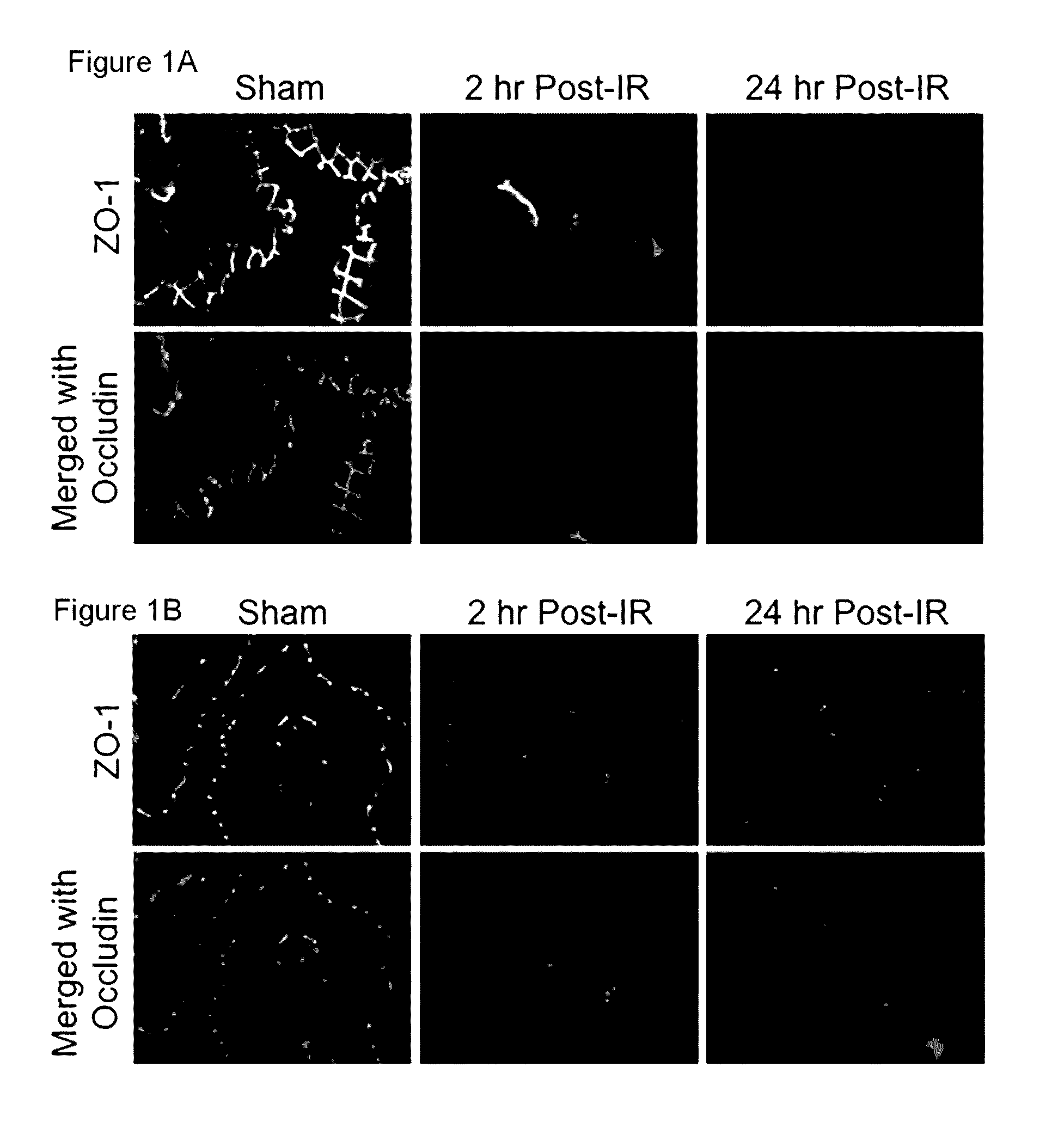 Compositions and methods for protecting colonic epithelial barrier function