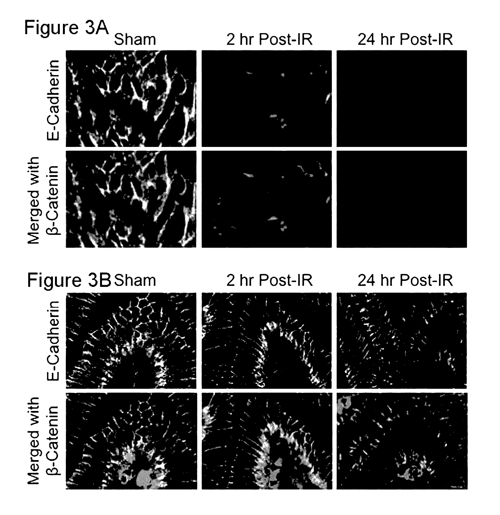 Compositions and methods for protecting colonic epithelial barrier function