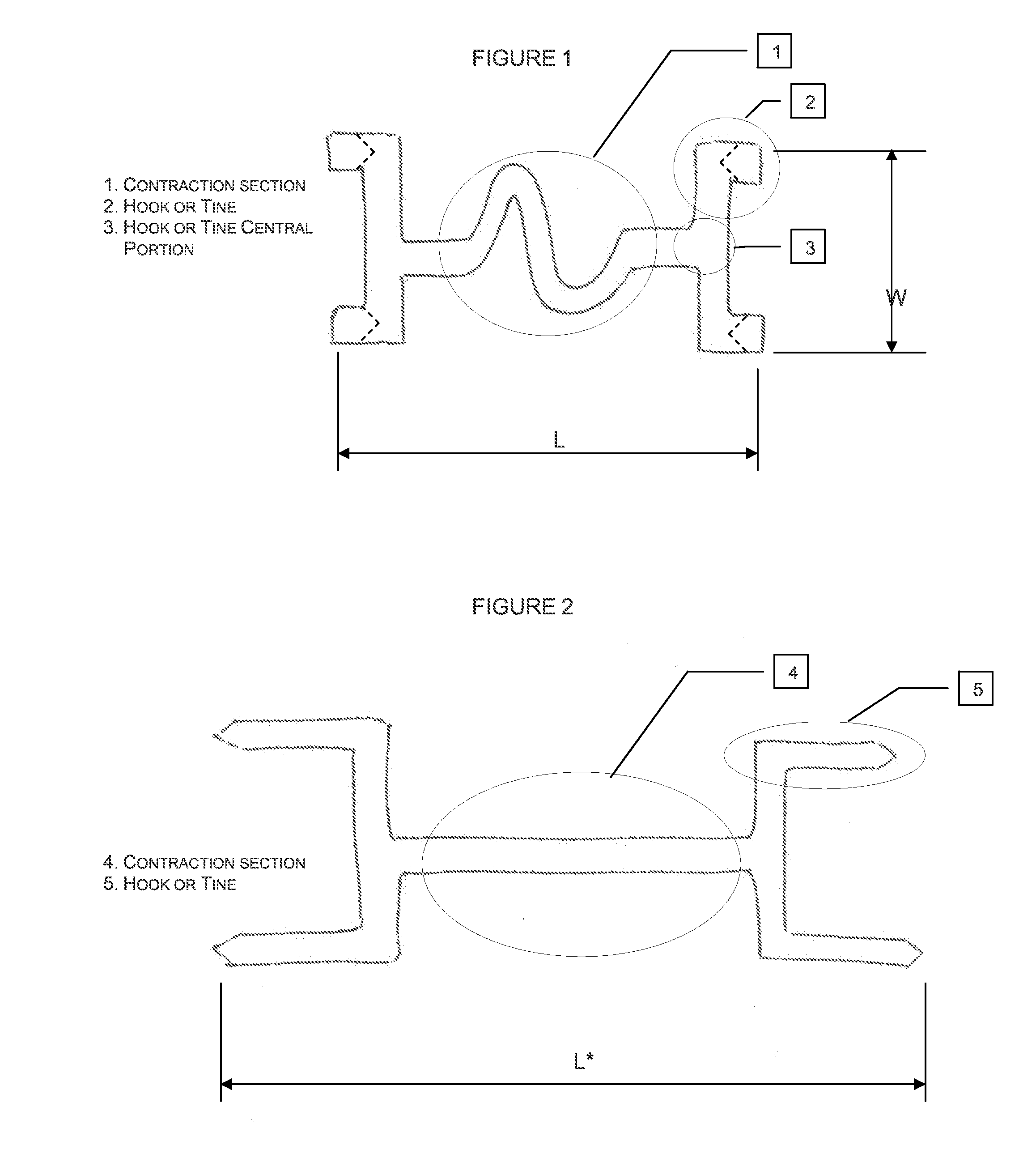 Implantable Tissue Structure Modifiers and Methods for Using the Same