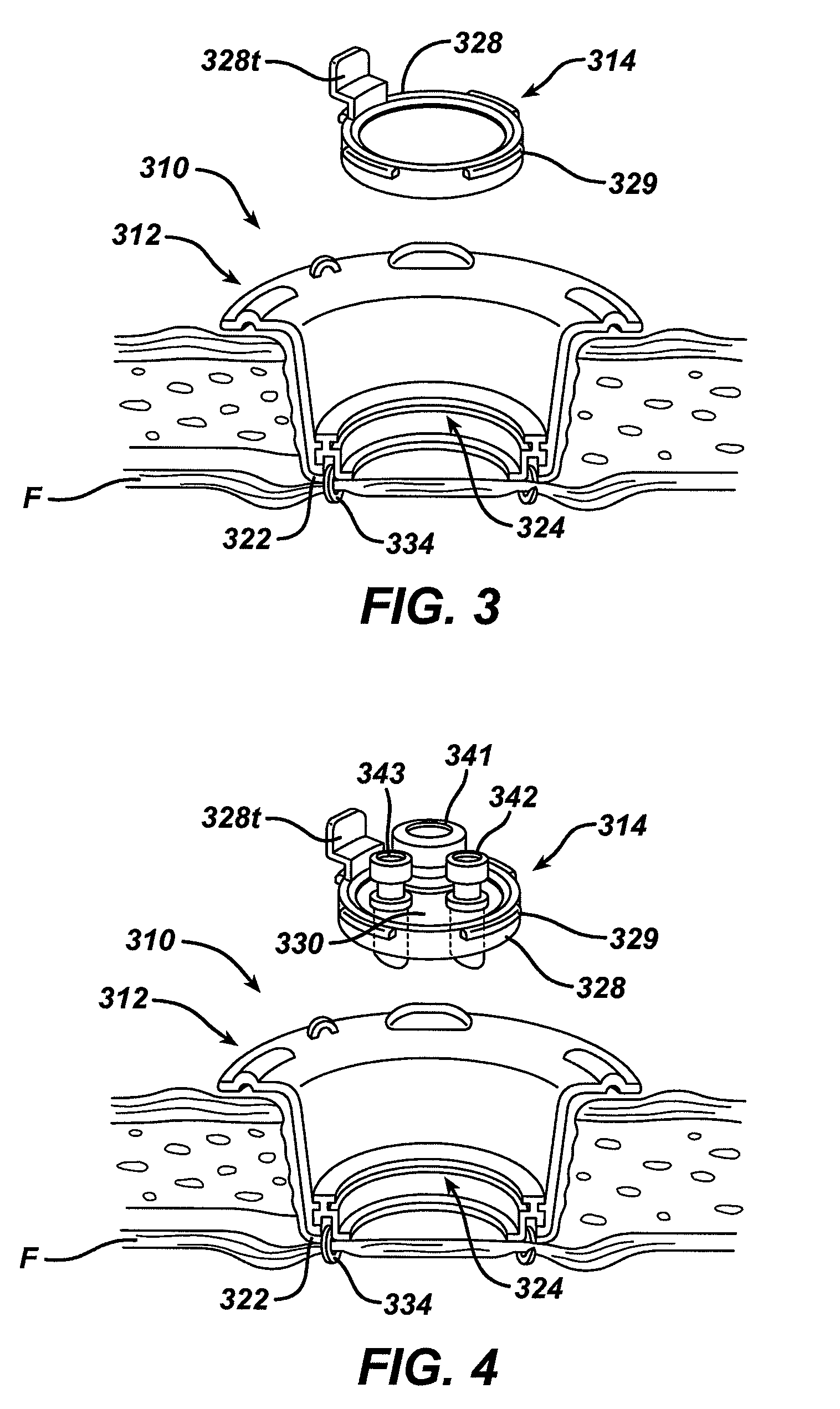 Methods and devices for accessing a body cavity using a surgical access device with modular seal components