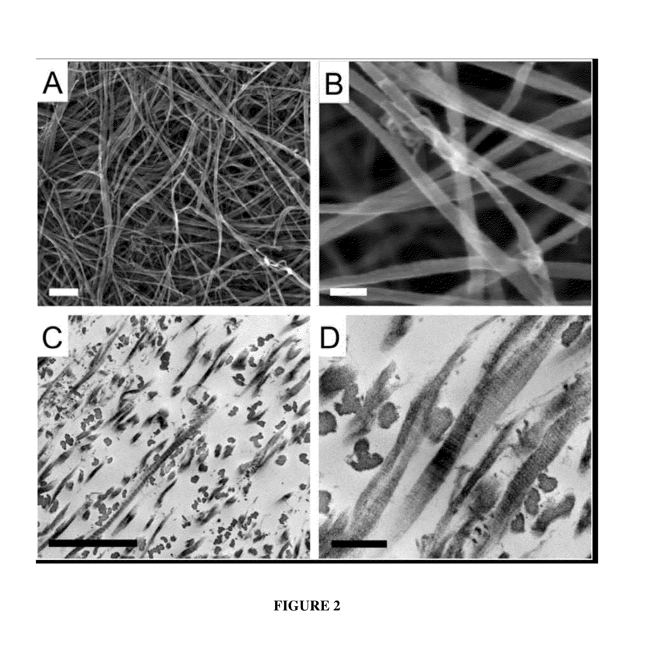 Collagen based materials and uses related thereto
