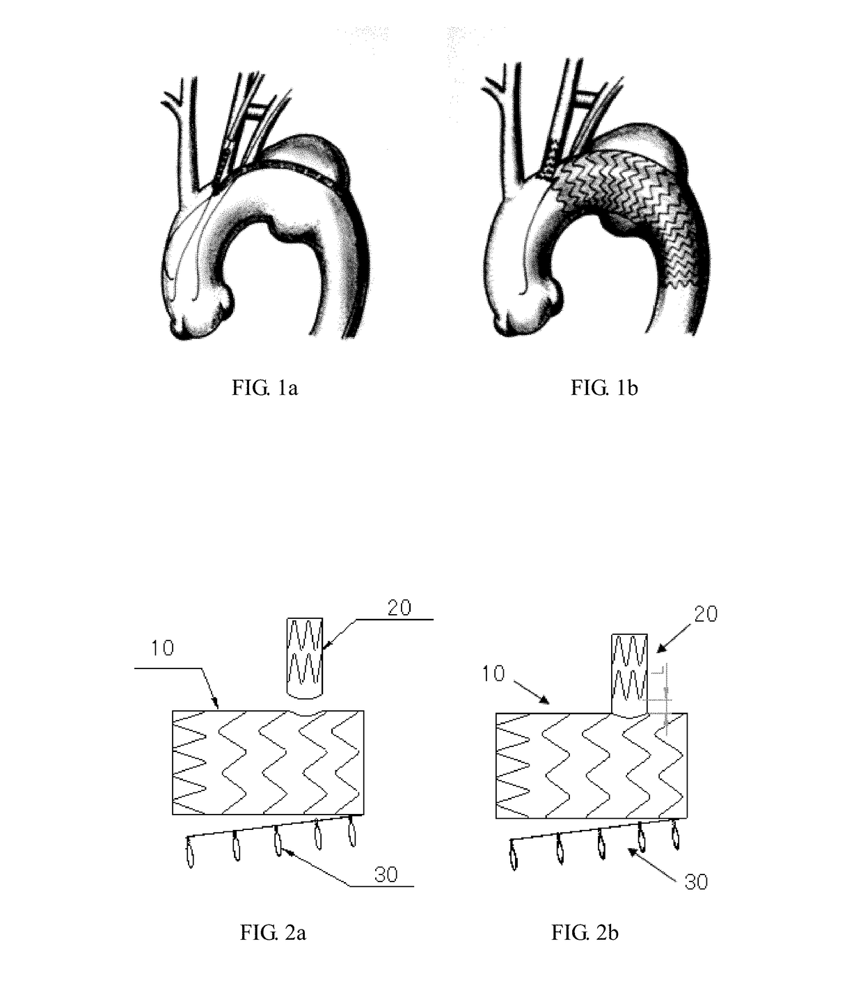 Branched stent graft, delivery system comprising same and method of fabricating same