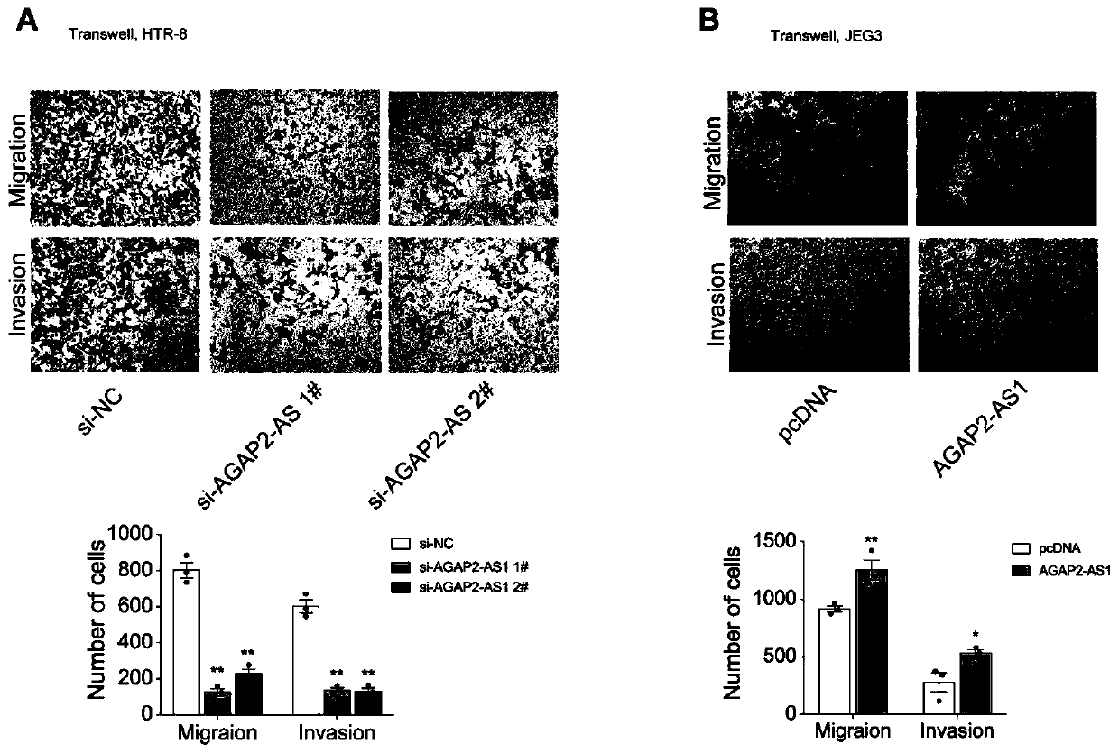 Long non-coding RNA and application thereof in diagnosis/treatment of preeclampsia