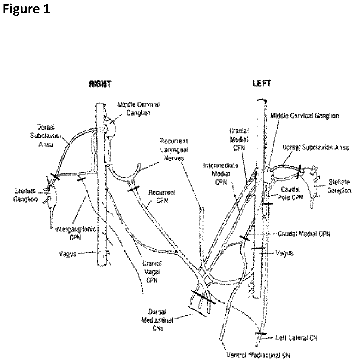 Treatment of cardiac dysfunction