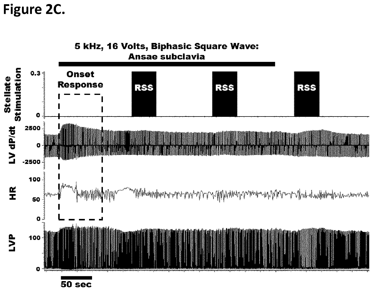 Treatment of cardiac dysfunction