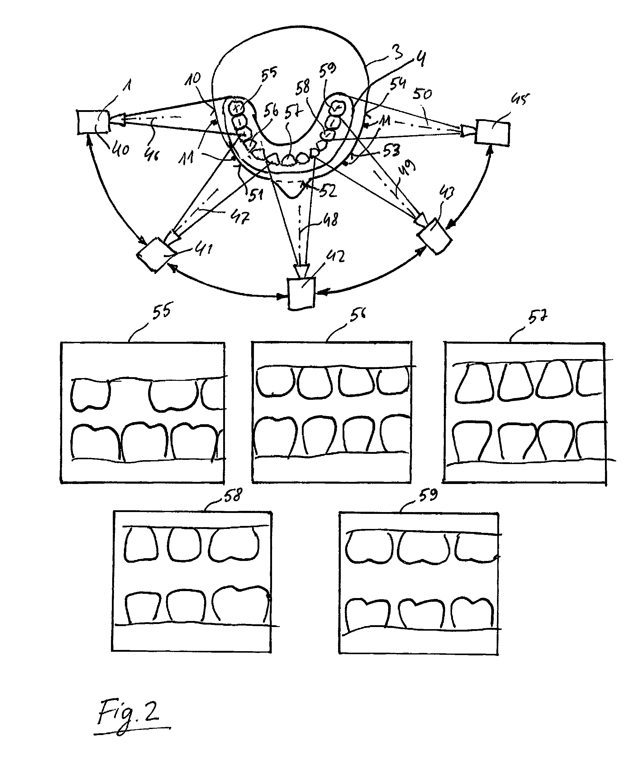 Method for planning a dental treatment