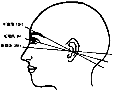 Method and system for correcting head position in head CT image