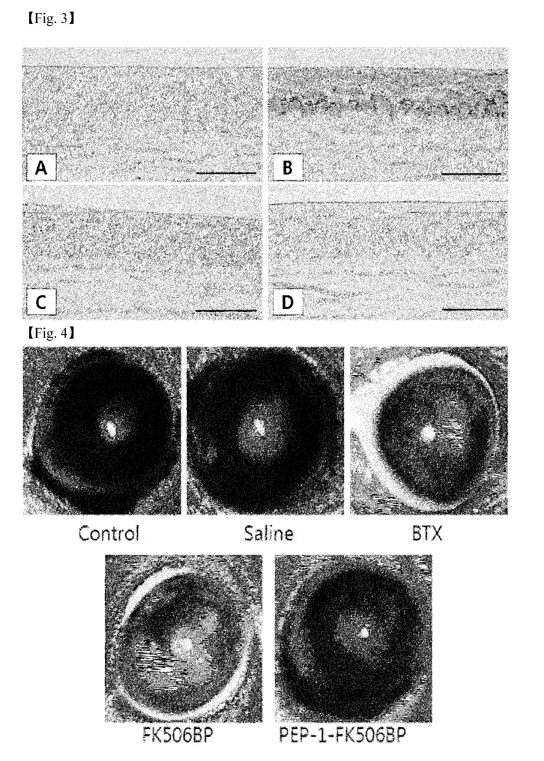 Eye drop composition for prevention and treatment of ophthalmic diseases containing fusion protein of fk506 binding protein