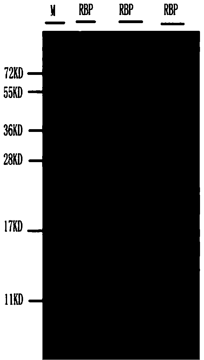 Process for purifying human retinol binding protein and preparation process of polyclonal antibody thereof