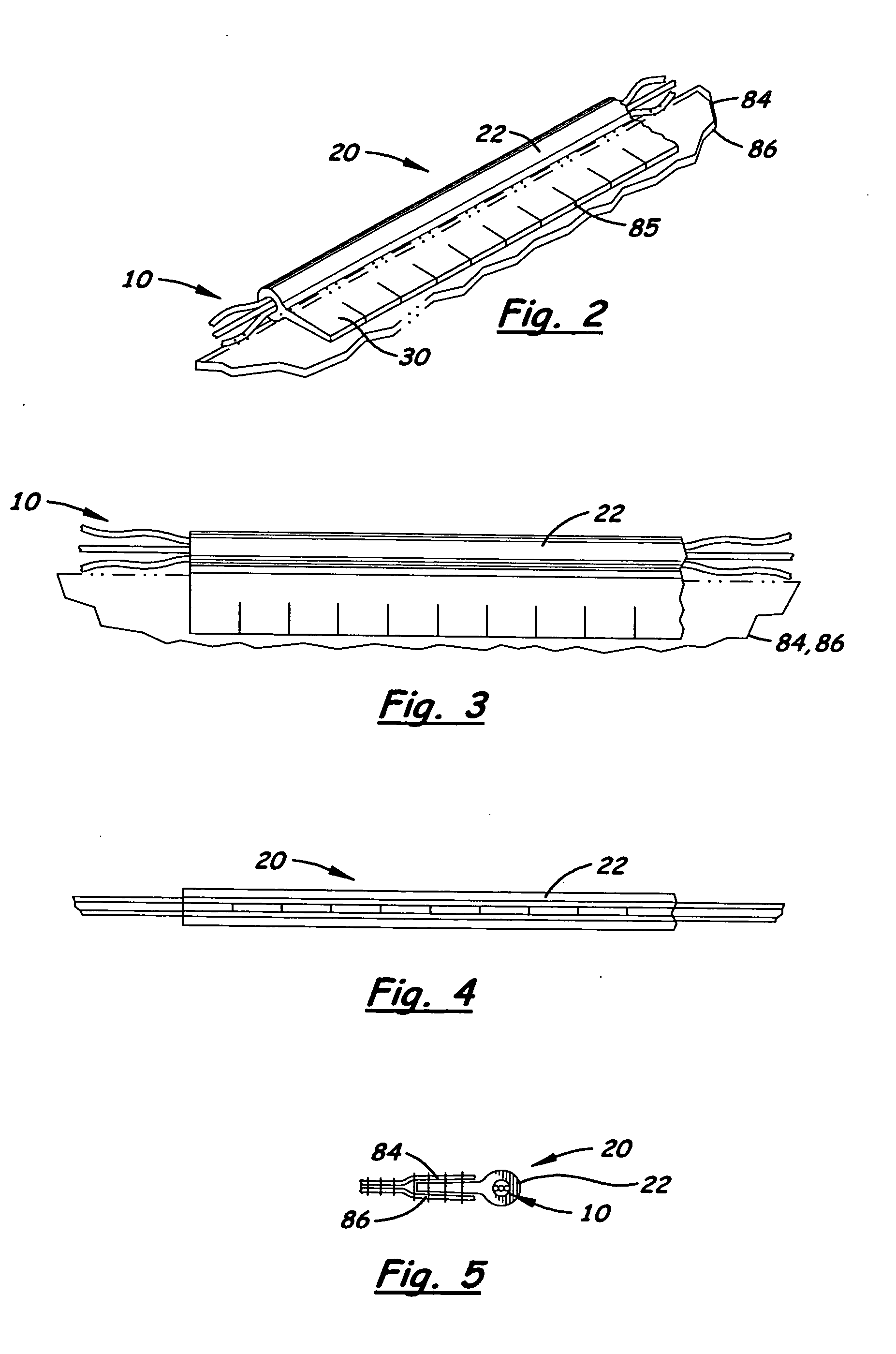 Mountable linear light welt