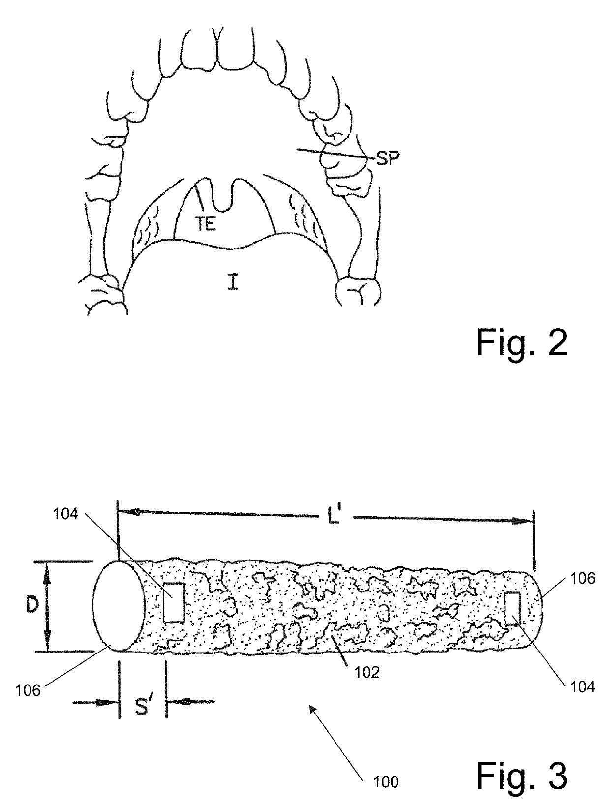 Airway implant delivery device