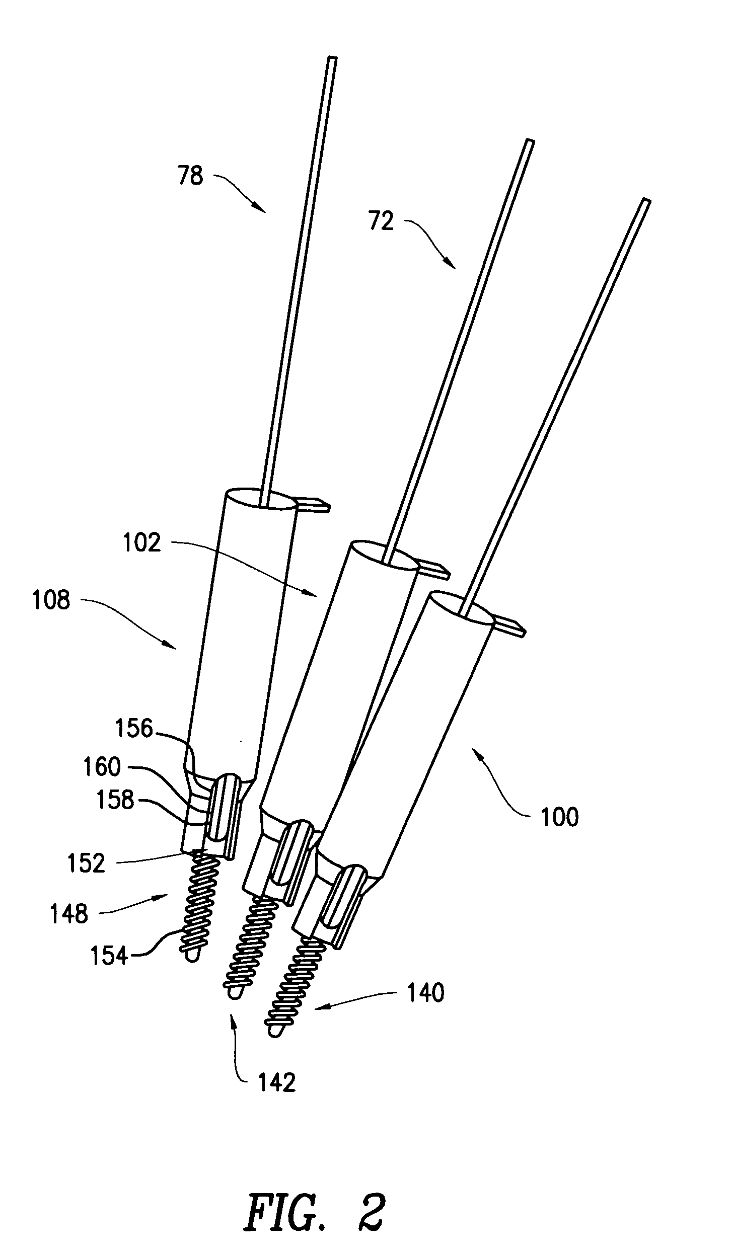 Rod contouring alignment linkage