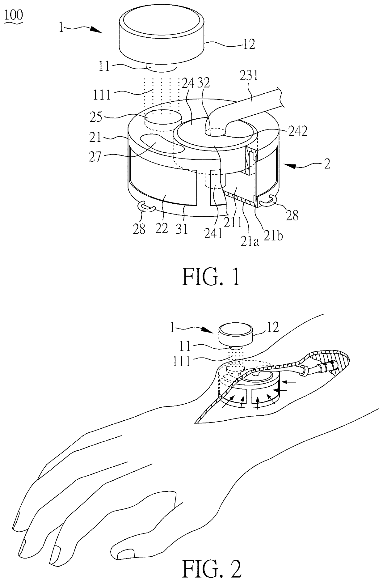 Apparatus for draining lymph into veins
