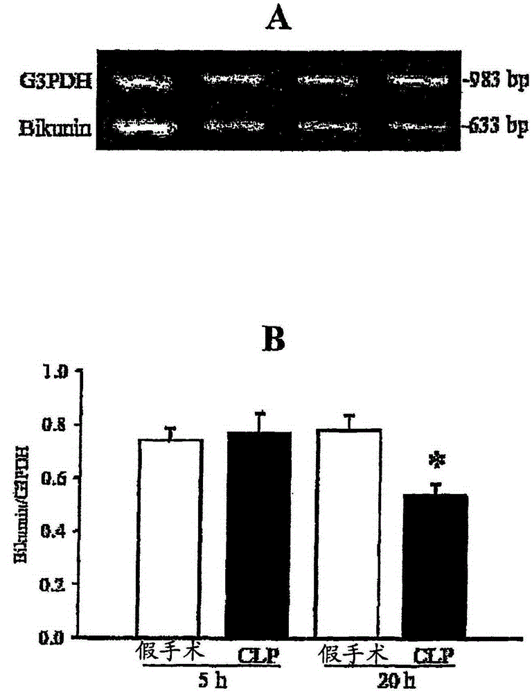 Preparation and composition of endo-alpha inhibitor protein from human plasma for therapeutic use
