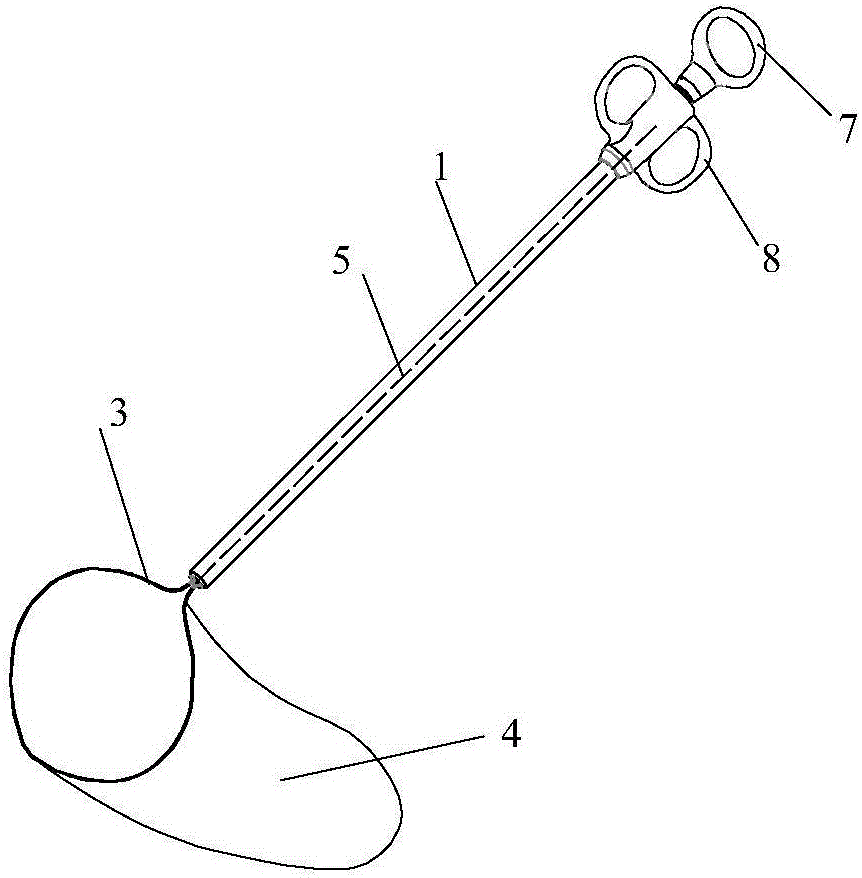 Excised tissue extractor