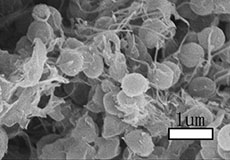 Preparation method of nitrogen-doped yolk-shaped carbon sphere/graphene composite material