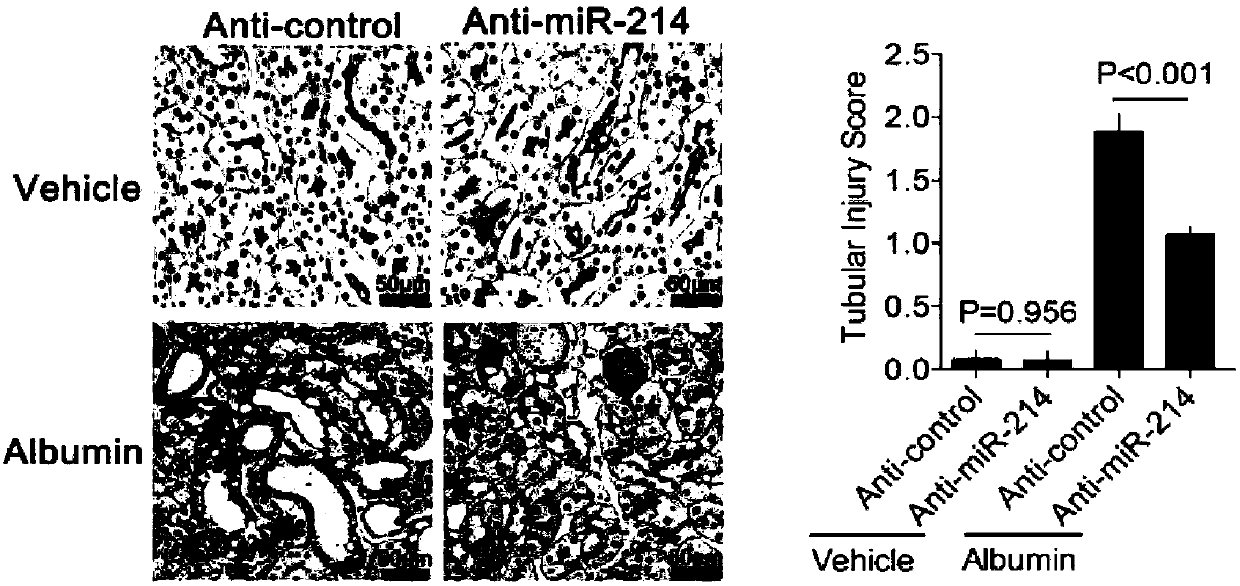 Application of miR-214 antagonist in preparing drug for relieving kidney tubule lesion-related diseases caused by proteinuria