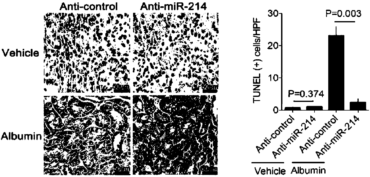 Application of miR-214 antagonist in preparing drug for relieving kidney tubule lesion-related diseases caused by proteinuria