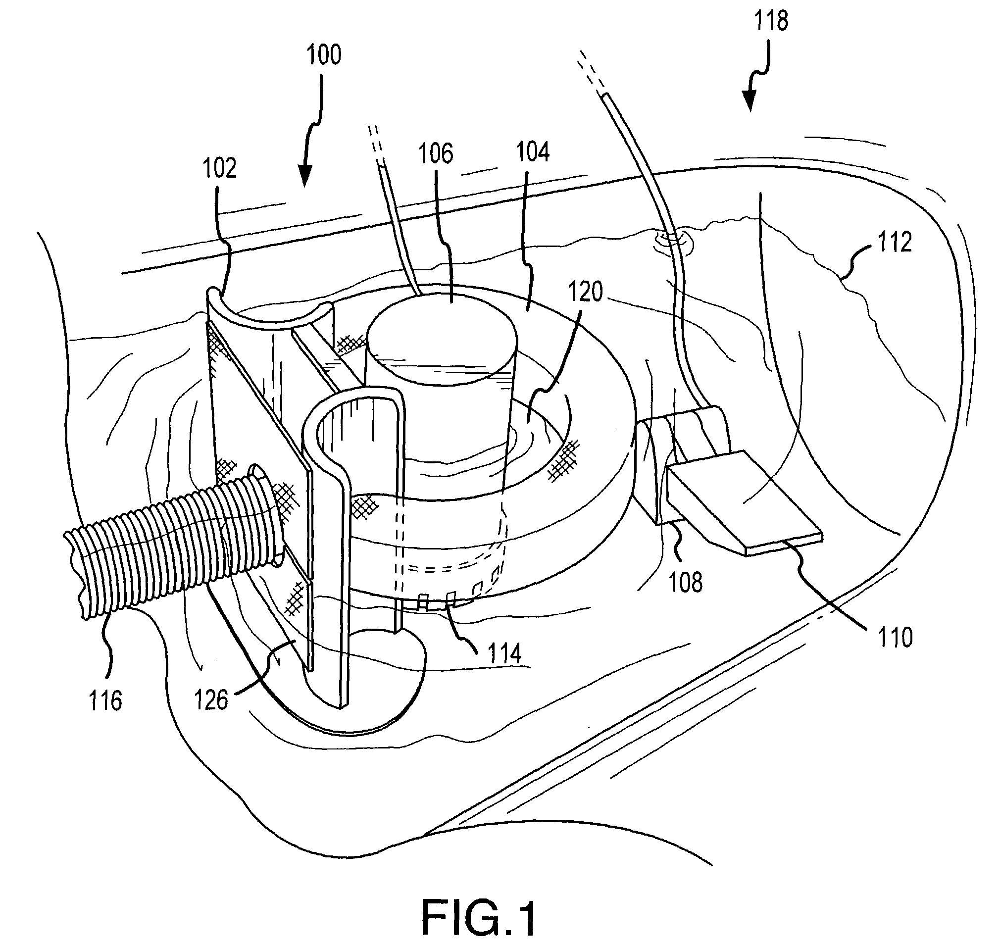 Water pollution prevention and remediation apparatus