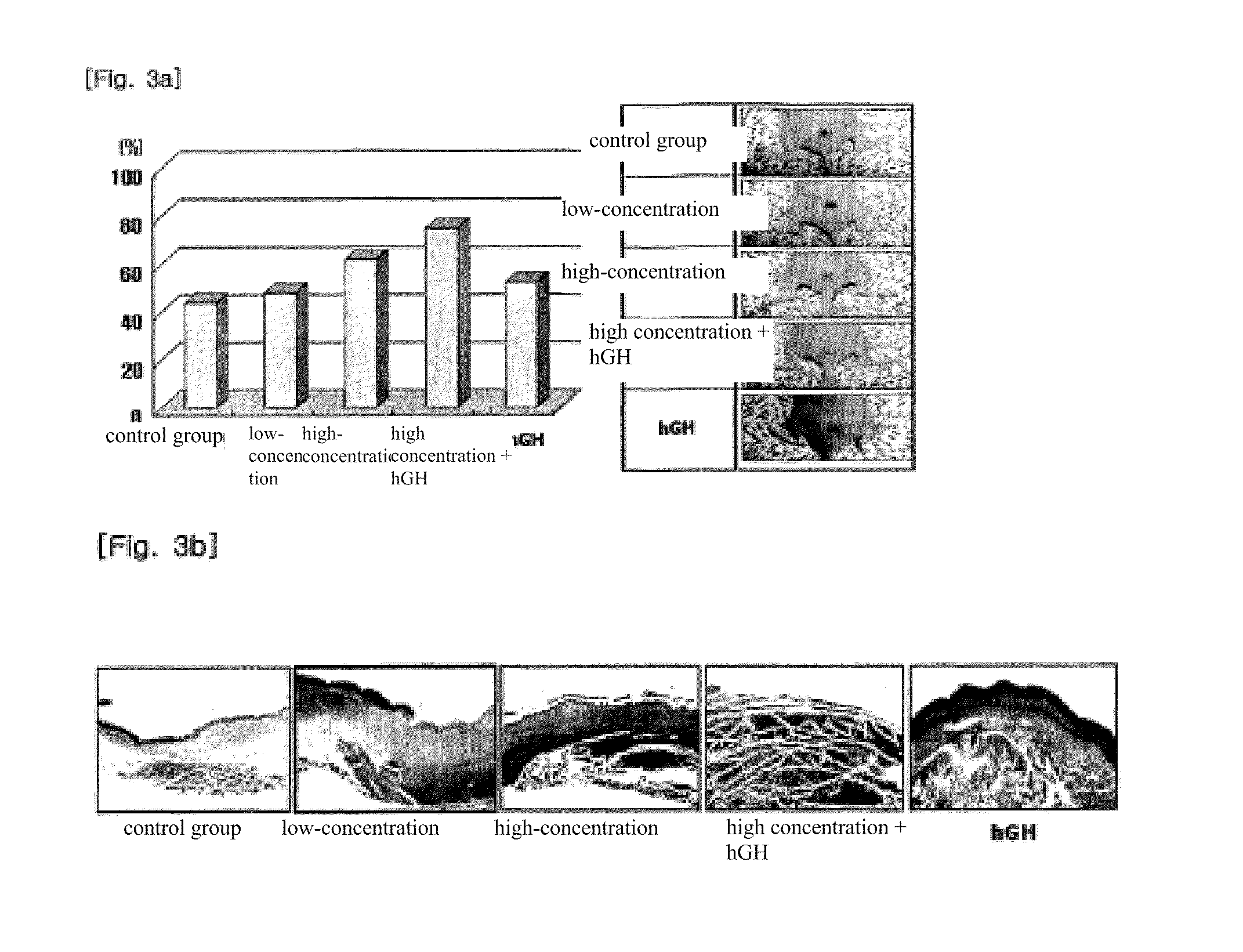 Composition for skin regeneration, containing a secretion in the culture of an embryonic stem cell-derived endothelial progenitor cell or fractions thereof, and use thereof
