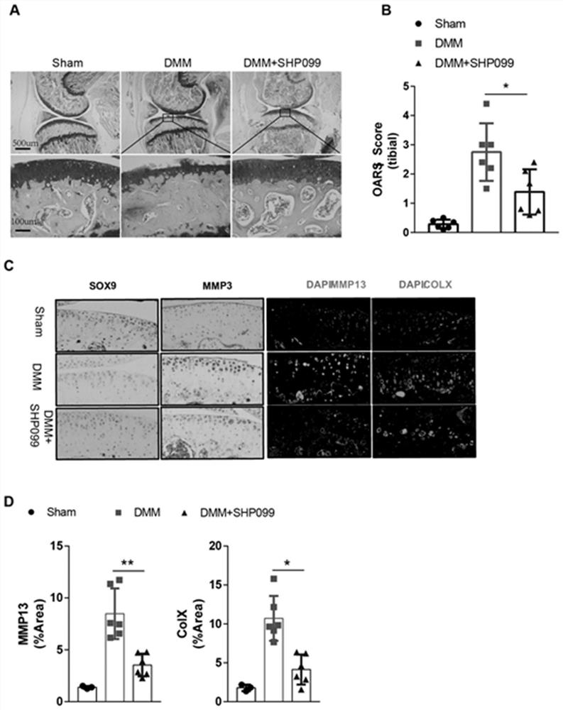 Application of protein tyrosine phosphatase SHP2 inhibitor in preparation of medicine for treating osteoarthritis (OA)