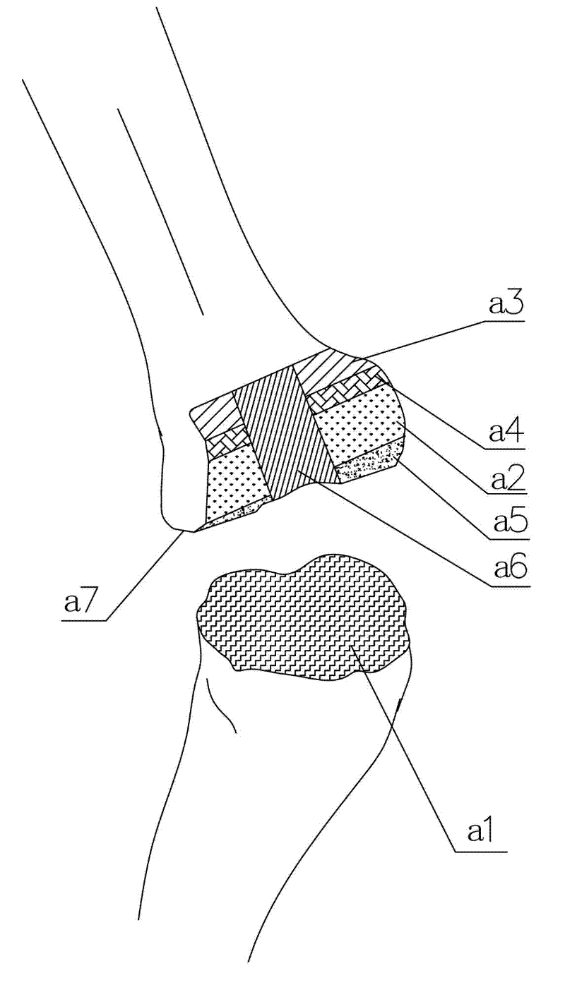 Positioning and bone-cutting system used for minimally invasive artificial knee joint replacement